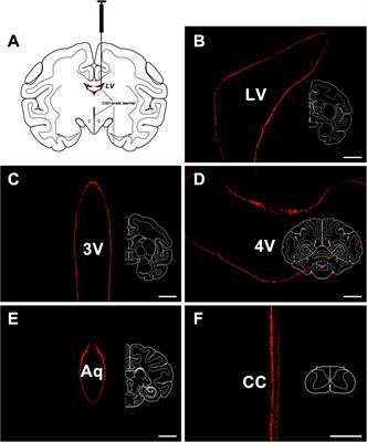 A Special Cranial Nucleus (CSF-Contacting Nucleus) in Primates